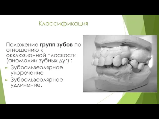 Классификация Положение групп зубов по отношению к окклюзионной плоскости (аномалии зубных дуг) :