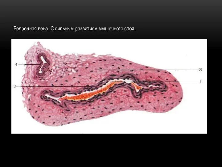 Бедренная вена. С сильным развитием мышечного слоя.