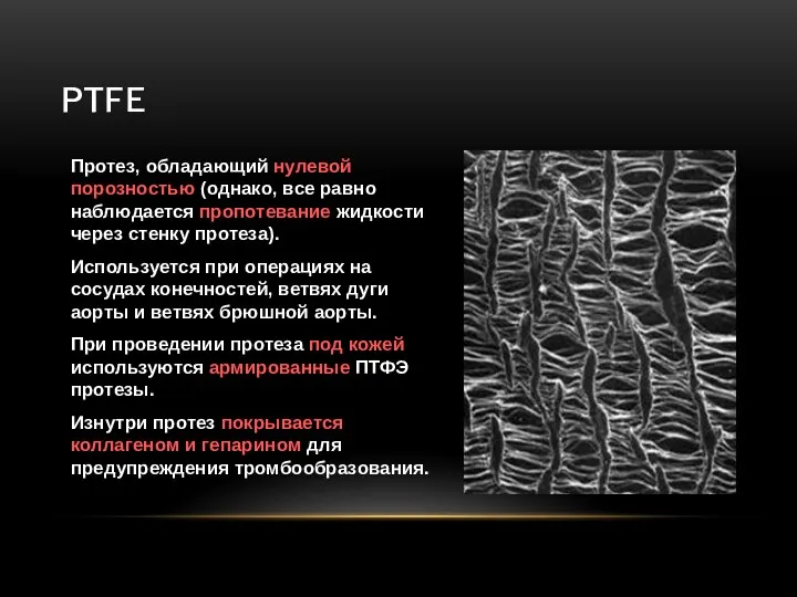 PTFE Протез, обладающий нулевой порозностью (однако, все равно наблюдается пропотевание