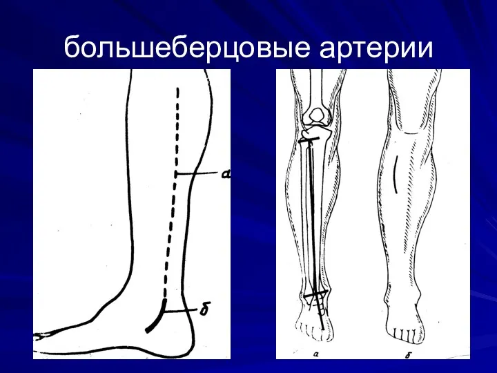 большеберцовые артерии