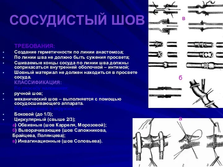 СОСУДИСТЫЙ ШОВ ТРЕБОВАНИЯ: Создание герметичности по линии анастомоза; По линии