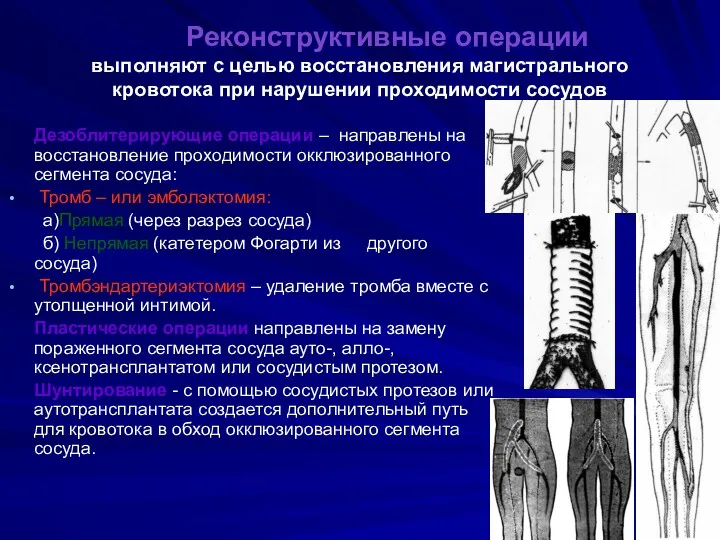 Реконструктивные операции выполняют с целью восстановления магистрального кровотока при нарушении