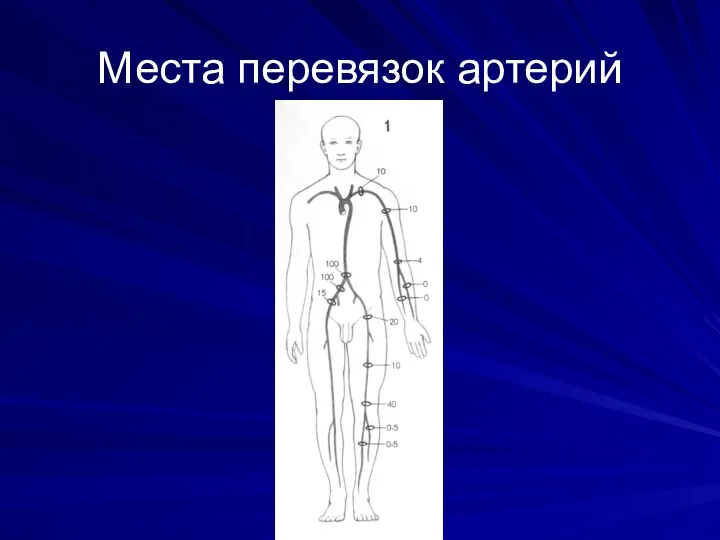 Места перевязок артерий