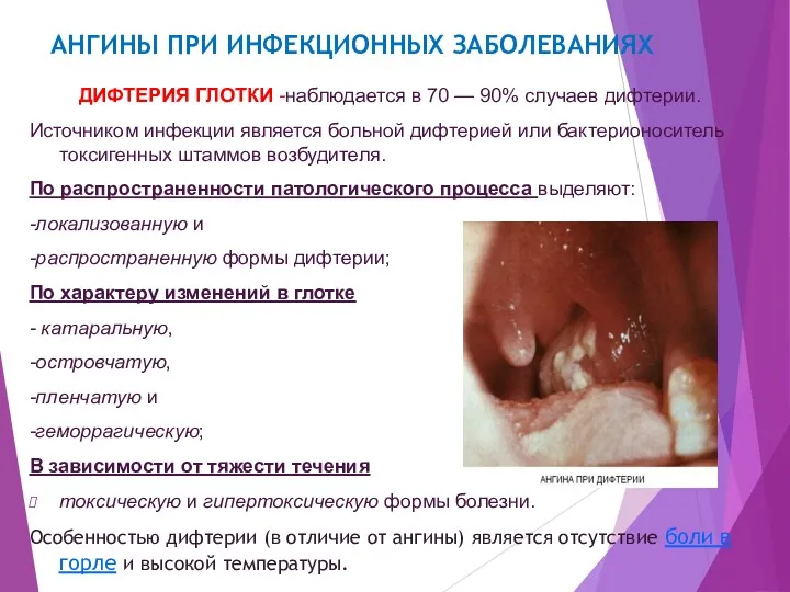 АНГИНЫ ПРИ ИНФЕКЦИОННЫХ ЗАБОЛЕВАНИЯХ ДИФТЕРИЯ ГЛОТКИ -наблюдается в 70 —