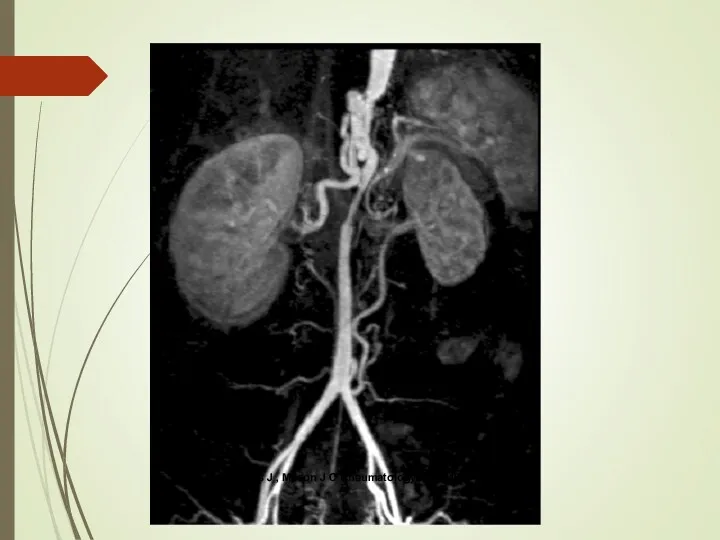 Andrews J , Mason J C Rheumatology 2007;46:6-15