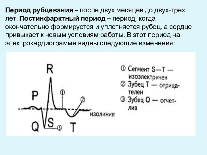 Период рубцевания – после двух месяцев до двух-трех лет. Постинфарктный