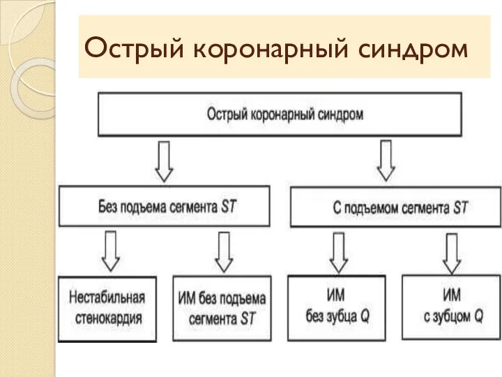 Острый коронарный синдром