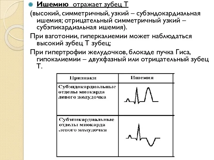 Ишемию отражает зубец Т (высокий, симметричный, узкий – субэндокардиальная ишемия;