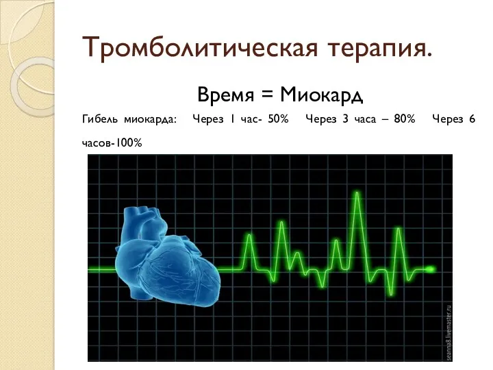 Тромболитическая терапия. Время = Миокард Гибель миокарда: Через 1 час-