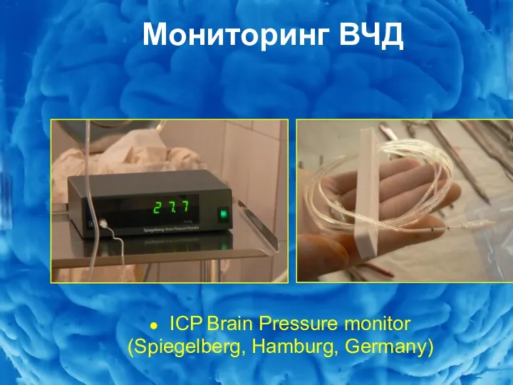 Мониторинг ВЧД ICP Brain Pressure monitor (Spiegelberg, Hamburg, Germany)