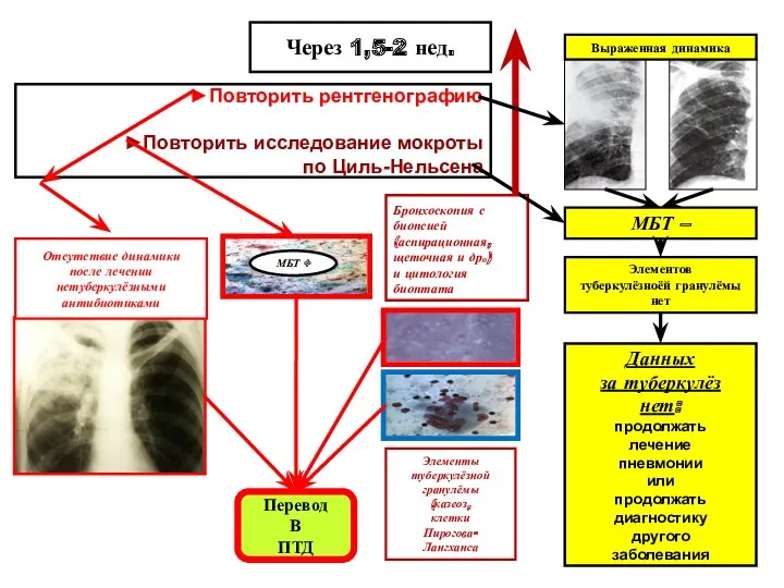 Через 1,5-2 нед. ►Повторить рентгенографию ►Повторить исследование мокроты по Циль-Нельсена