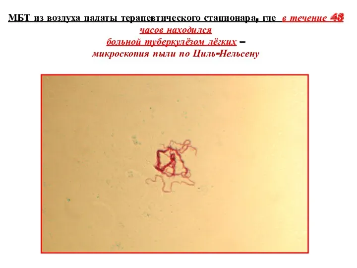 МБТ из воздуха палаты терапевтического стационара, где в течение 48