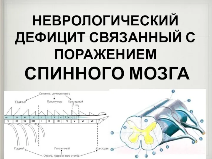 НЕВРОЛОГИЧЕСКИЙ ДЕФИЦИТ СВЯЗАННЫЙ С ПОРАЖЕНИЕМ СПИННОГО МОЗГА