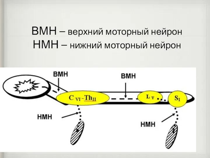 ВМН – верхний моторный нейрон НМН – нижний моторный нейрон