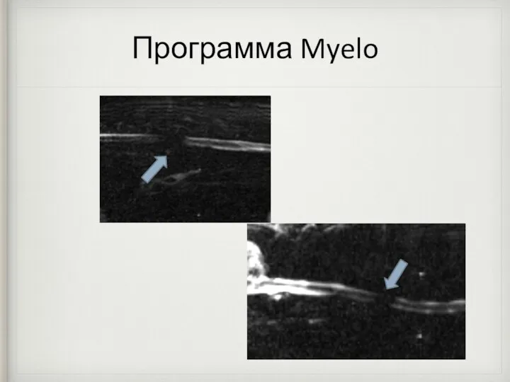 Программа Myelo