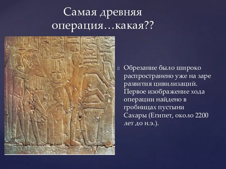 Обрезание было широко распространено уже на заре развития цивилизаций. Первое изображение хода операции