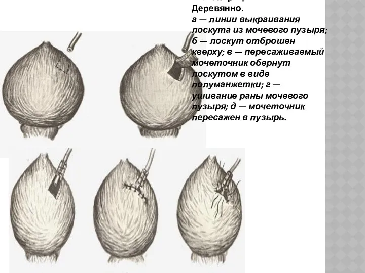 124. Операция И. М. Деревянно. а — линии выкраивания лоскута