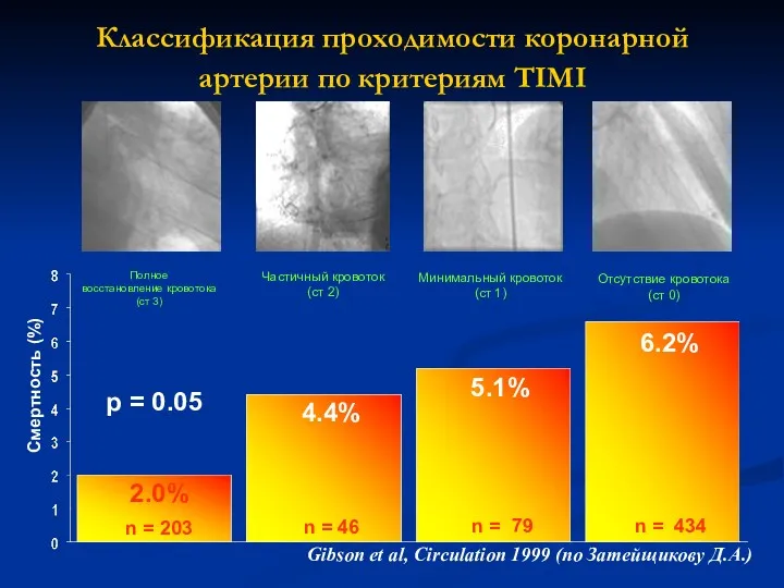 Классификация проходимости коронарной артерии по критериям TIMI 6.2% 4.4% 2.0% n = 203