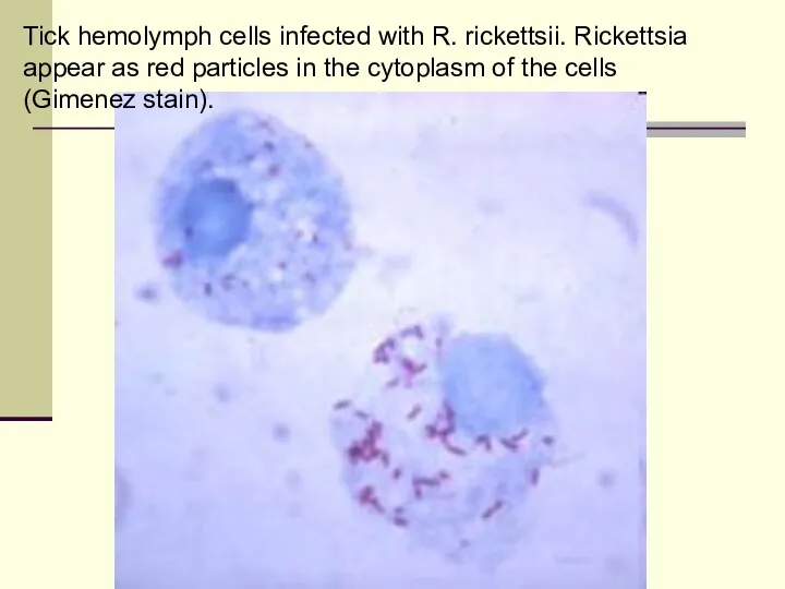 Tick hemolymph cells infected with R. rickettsii. Rickettsia appear as