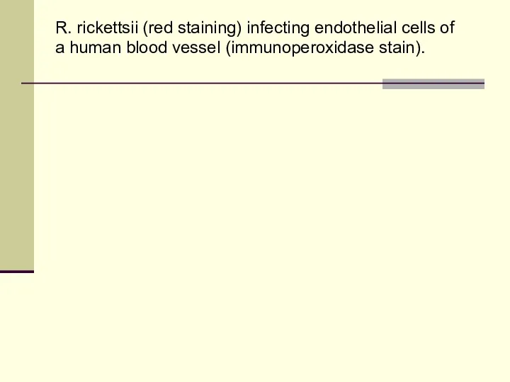 R. rickettsii (red staining) infecting endothelial cells of a human blood vessel (immunoperoxidase stain).