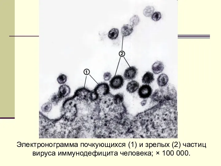 Электронограмма почкующихся (1) и зрелых (2) частиц вируса иммунодефицита человека; × 100 000.