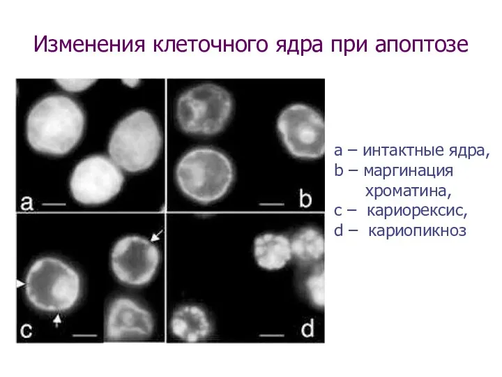 Изменения клеточного ядра при апоптозе а – интактные ядра, b