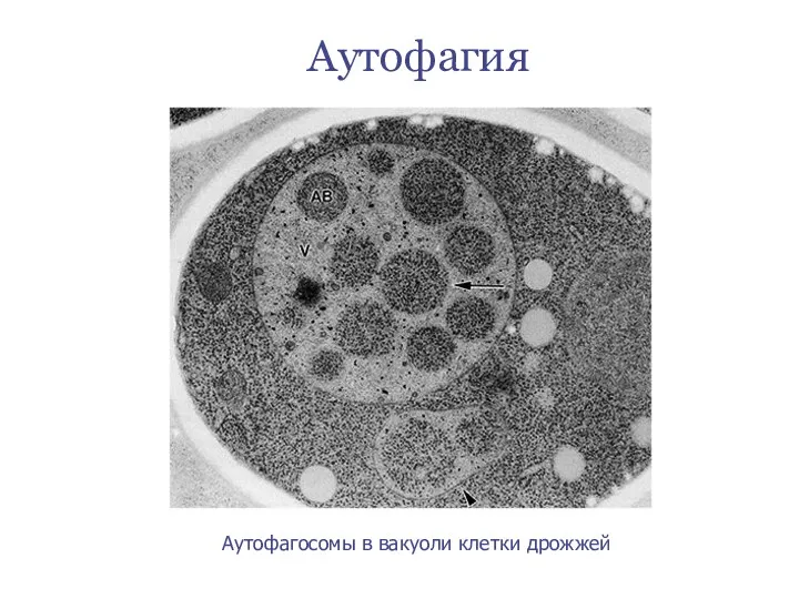 Аутофагосомы в вакуоли клетки дрожжей Аутофагия