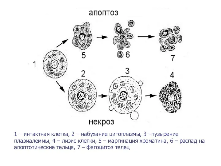 1 – интактная клетка, 2 – набухание цитоплазмы, 3 –пузырение
