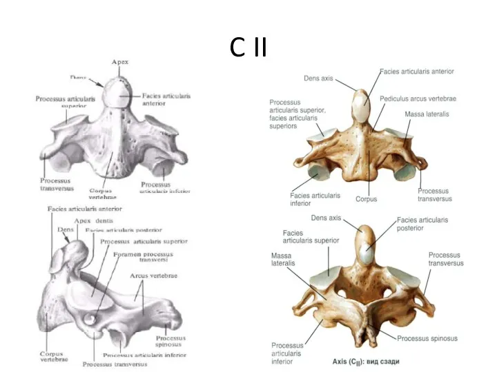 C II