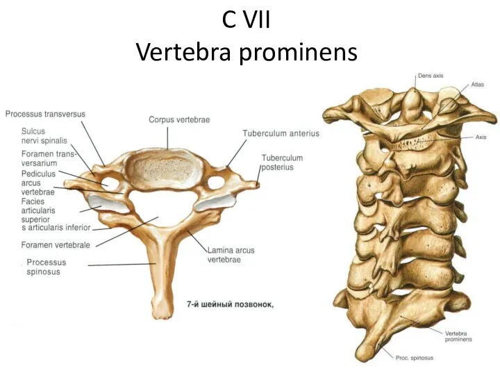 C VII Vertebra prominens