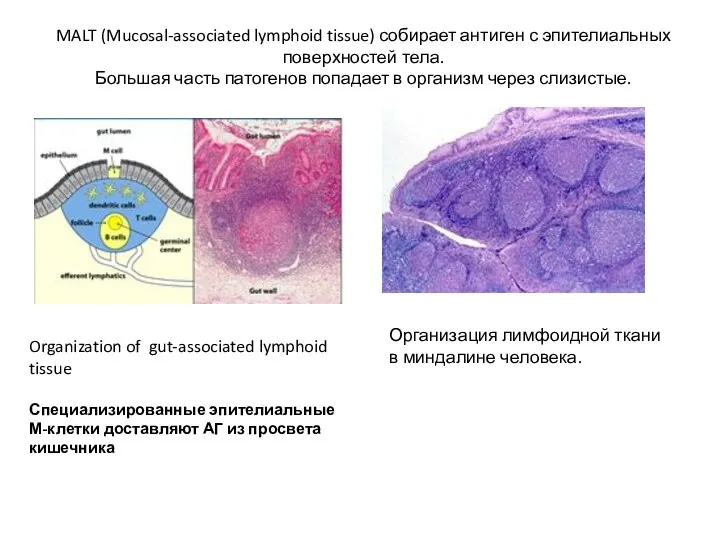 MALT (Mucosal-associated lymphoid tissue) собирает антиген с эпителиальных поверхностей тела. Большая часть патогенов
