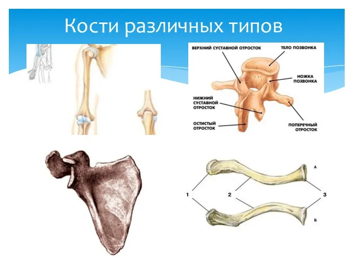 Кости различных типов