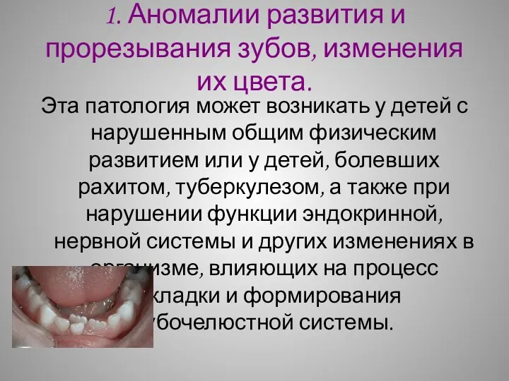 1. Аномалии развития и прорезывания зубов, изменения их цвета. Эта