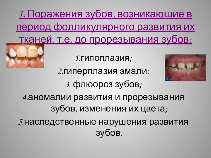 I. Поражения зубов, возникающие в период фолликулярного развития их тканей,