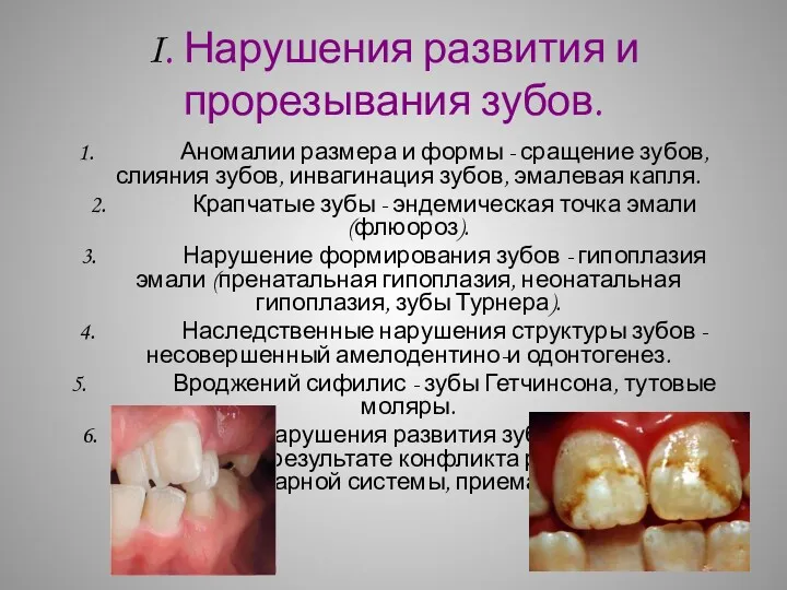 I. Нарушения развития и прорезывания зубов. 1. Аномалии размера и