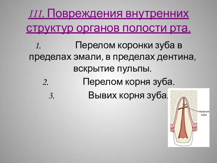 III. Повреждения внутренних структур органов полости рта. 1. Перелом коронки
