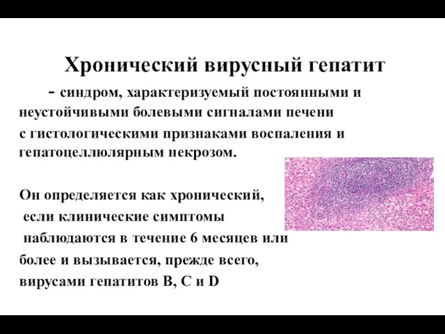 Хронический вирусный гепатит - синдром, характеризуемый постоянными и неустойчивыми болевыми