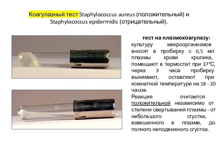 Коагулазный тест Staphylococcus aureus (положительный) и Staphylococcus epidermidis (отрицательный). тест