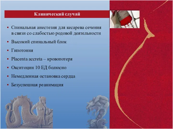 Спинальная анестезия для кесарева сечения в связи со слабостью родовой