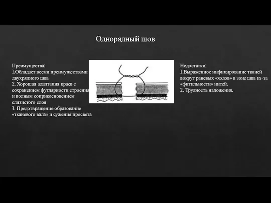 Преимущества: 1.Обладает всеми преимуществами двухрядного шва 2. Хорошая адаптация краев