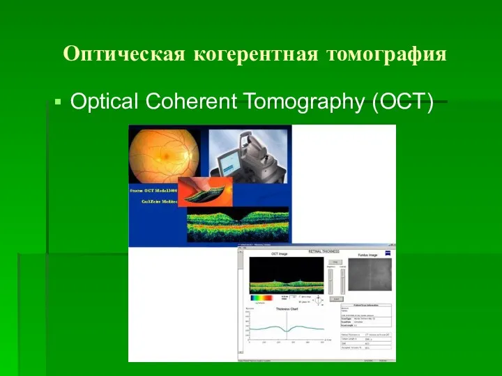 Оптическая когерентная томография Optical Coherent Tomography (OCT)
