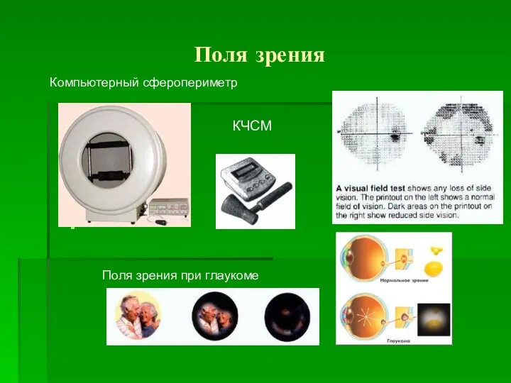 Поля зрения КЧСМ Компьютерный сферопериметр Поля зрения при глаукоме