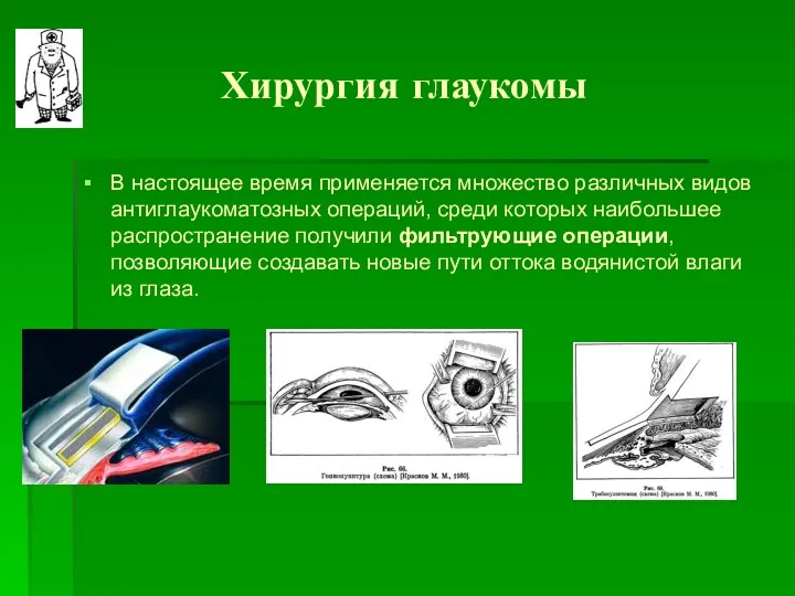 Хирургия глаукомы В настоящее время применяется множество различных видов антиглаукоматозных операций, среди которых