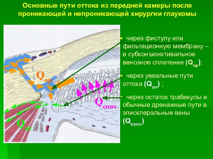 Основные пути оттока из передней камеры после проникающей и непроникающей хирургии глаукомы через