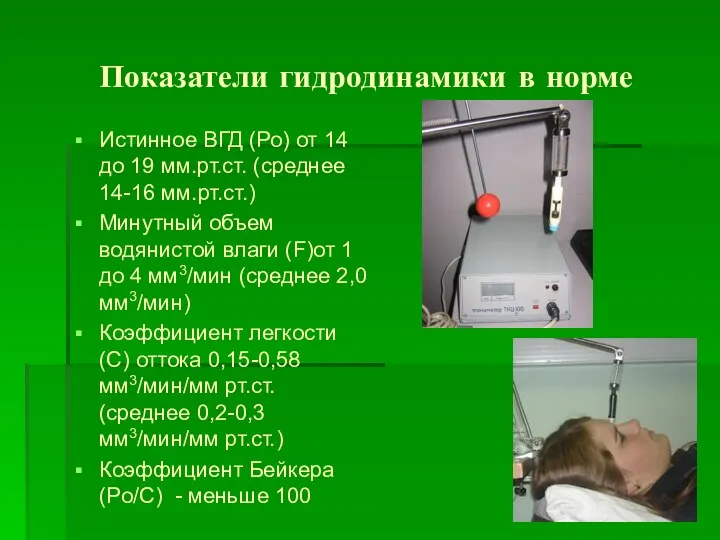 Показатели гидродинамики в норме Истинное ВГД (Ро) от 14 до 19 мм.рт.ст. (среднее