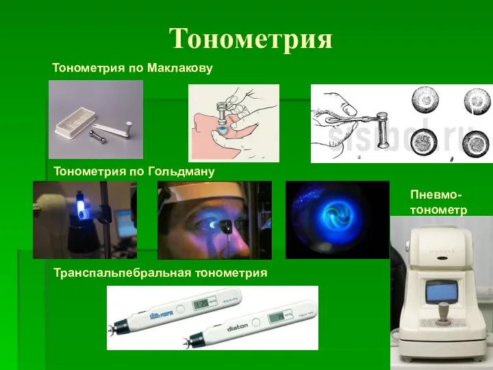 Тонометрия Тонометрия по Маклакову Тонометрия по Гольдману Транспальпебральная тонометрия Пневмо- тонометр