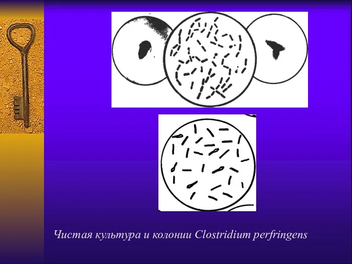 Чистая культура и колонии Clostridium perfringens