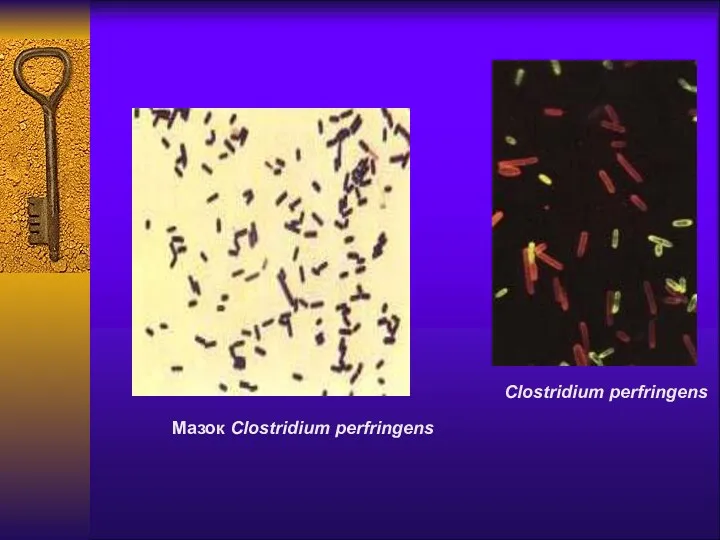 Мазок Clostridium perfringens Clostridium perfringens