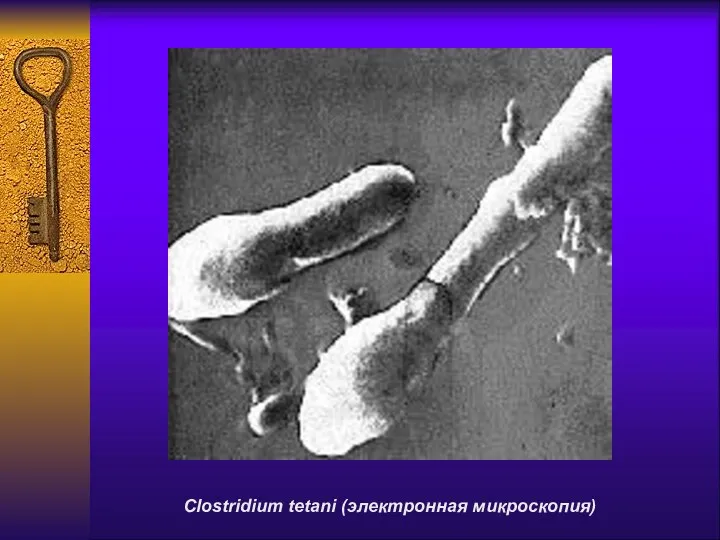 Clostridium tetani (электронная микроскопия)