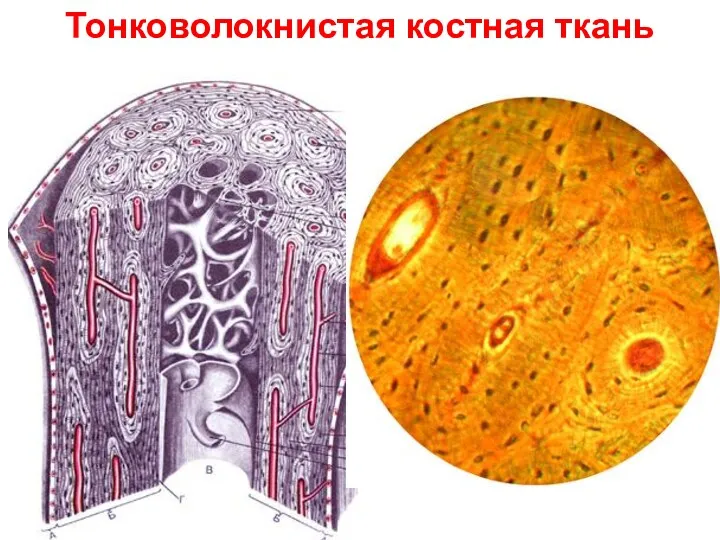 Тонковолокнистая костная ткань